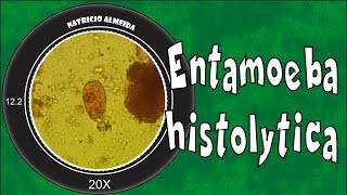 Entamoeba histolyticadispar [upl. by Wrigley167]