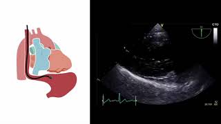 Basics of Transthoracic Echocardiography Dr Viola William [upl. by Keli938]