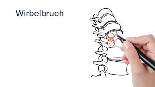 Behandlung Wirbelbruch by ATOS Kliniken [upl. by Monaco]