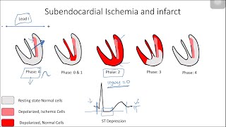 ST Elevation and Depression Electrophysiological Basis [upl. by Iggep]