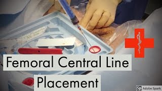 Femoral Central Line Placement [upl. by Yelra]