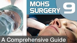 The Recovery Process after Mohs Surgery [upl. by Hoeg]