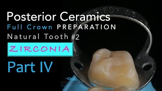 Zirconia Ceramics Part 4 AllCeramic Crown Preparation 2 Natural Tooth [upl. by Ettezoj]