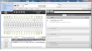 CS R4 2 Minute Training Printing a treatment plan [upl. by Garrick]