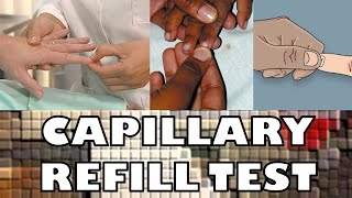 CAPILLARY REFILL TEST  FAST amp SIMPLE  Ohio University  Human Anatomy amp Physiology [upl. by Aynnat]