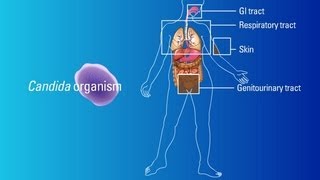 Sources of Candida Organisms [upl. by Cloots]