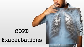 COPD Exacerbations [upl. by Janeen]