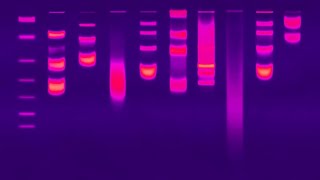 Gel Electrophoresis [upl. by Sardse]