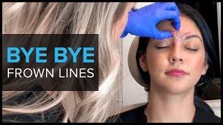 Botox for Migraine by Dr Andrew Blumenfeld [upl. by Ynalem]