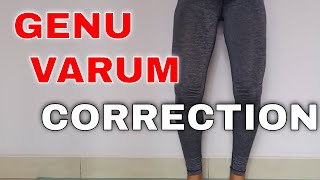 5 GENU VARUM CORRECTION EXERCISES  Yoga For Bow Legs [upl. by Timothee]