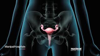 Pathophysiology of Preeclampsia  ObGyn  NEET PG 2021  Dr Shonali Chandra [upl. by Scotty]