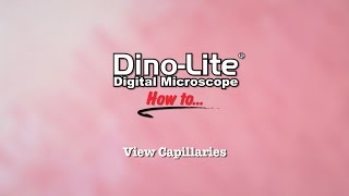 How to View Capillaries using DinoLite USB Microscopes [upl. by O'Donnell730]