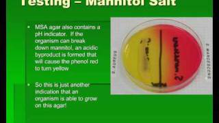 Introduction to Streptococcus [upl. by Yatnuahs]