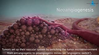 Characteristics of Cancer Cells [upl. by Barimah]