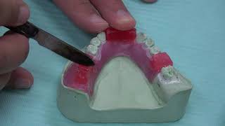 Acrylic Partial Denture  MMR optech [upl. by Mosra]