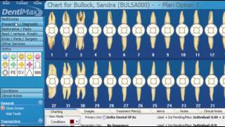 Mastering Charting in Dental Software Pt 1  DentiMax Webinar [upl. by Underwood]