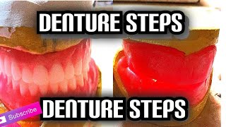 Denture Steps Bite Blocks and Bite Registration [upl. by Ycal]