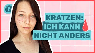 Skinpicking Krankhaft Pickel ausdrücken🩸😣  Auf Klo [upl. by Qirat]