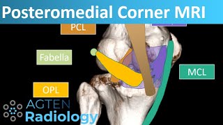 Posteromedial Corner Anatomy on Knee MRI [upl. by Yanrahc605]