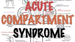 Compartment Syndrome  Overview signs and symptoms pathophysiology treatment [upl. by Nanah79]