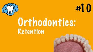 Orthodontics  Retention  INBDE ADAT [upl. by Adolfo]