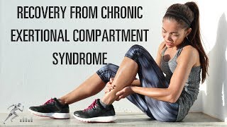 Recovery from chronic exertional compartment syndrome CECS [upl. by Libyc406]