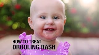 How to treat Drooling Rash [upl. by Nilerual]