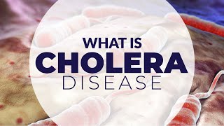 WHAT IS CHOLERA DISEASE [upl. by Willing943]