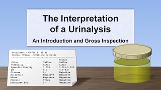 Interpretation of the Urinalysis Part 1  Introduction and Inspection [upl. by Thaddus]