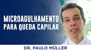 Microagulhamento  Tratamento para Queda de Cabelo – Dr Paulo Müller Dermatologista [upl. by Urbannal687]