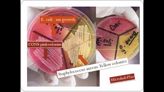 Mannitol salt agar  Staphylococcus aureus  MSA [upl. by Hashimoto]